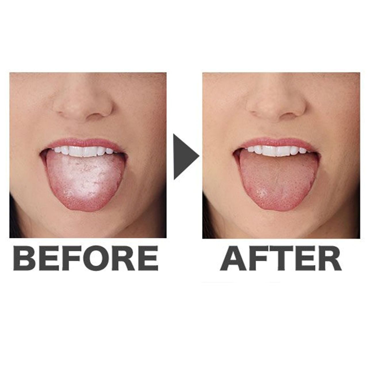 コケとっと®プレミアムⅡ mini