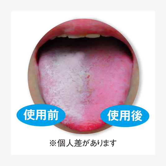 舌ブラシ　W-1/ピンク